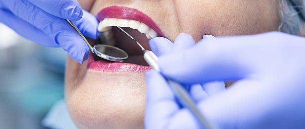 Best Emergency Dental Care for Abscessed Tooth in Summerfield, MD